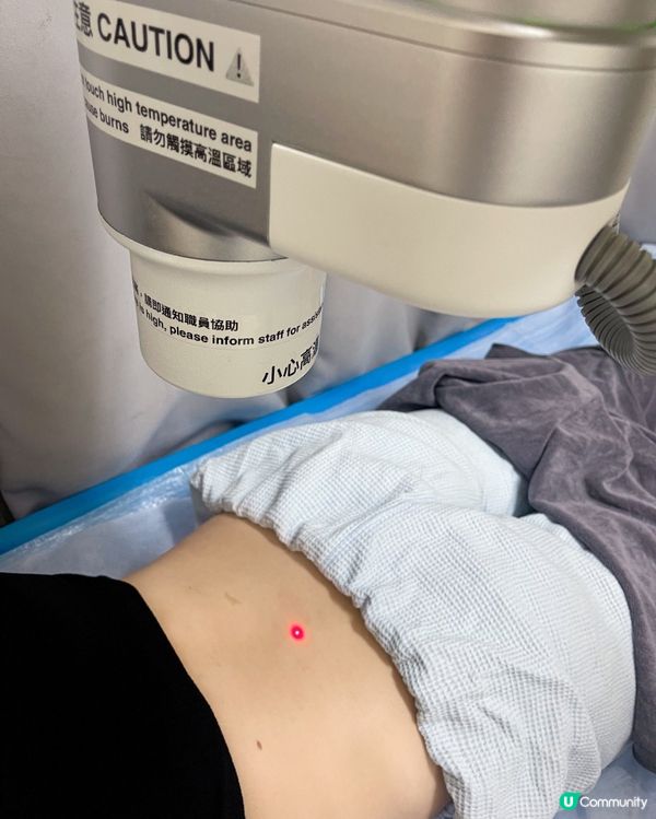 養康中醫館嘅AI艾灸機器人🤖腰痛即日消除