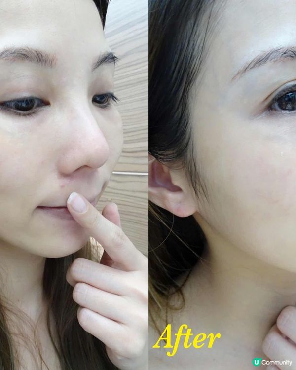 溫和去痘印雀班 ～ Caudalie葡萄美白系列 ～ 敏感肌都用得的葡萄美白