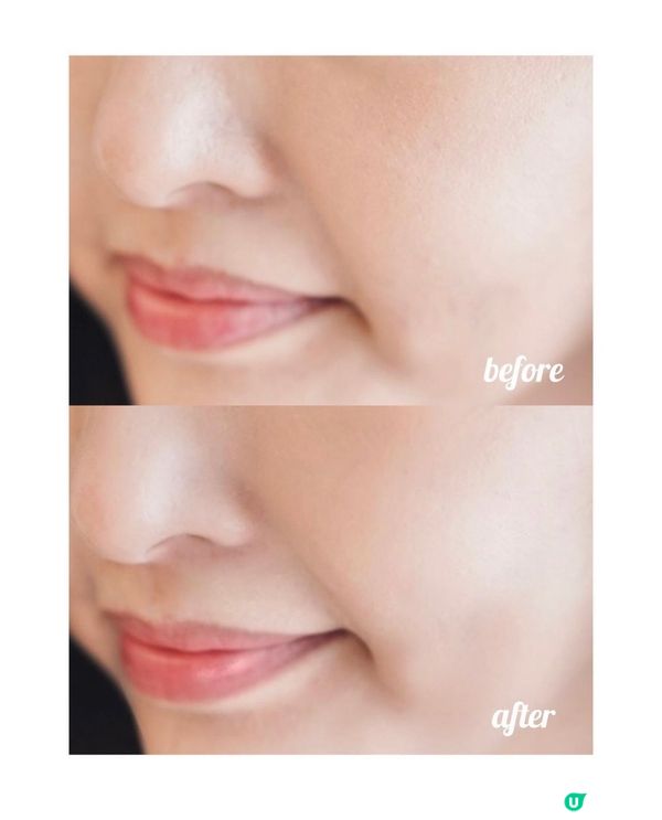 🍀 innisfree 抗痘修護套裝