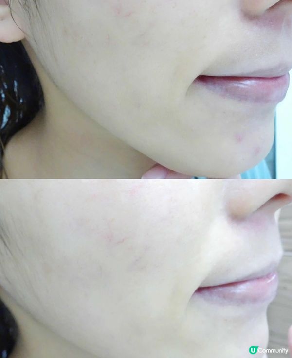 美白肌膚就係咁簡單 ～ Kiehl’s 皇牌淨白亮肌系列 ～ 敏感肌膚必備