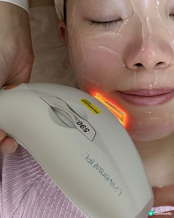 為皮膚開濾鏡✨!Light Filter M22脈衝光💖