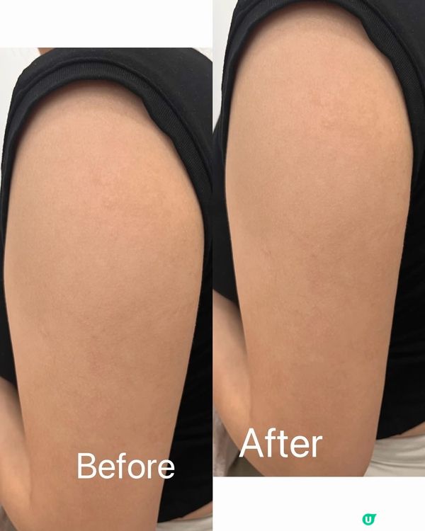 超開心😍竟然俾人讚我瘦咗💕💕