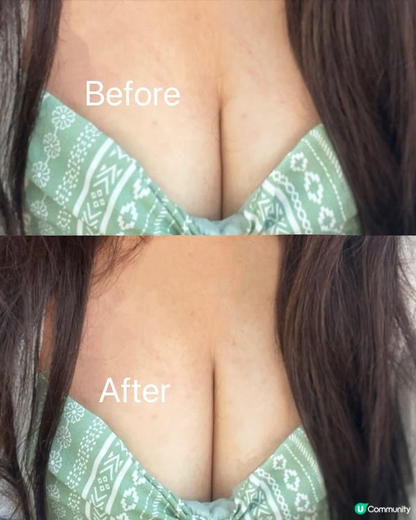 意大利🇮🇹製造嘅✨MRE 豐胸乳霜✨，效果超好🫶