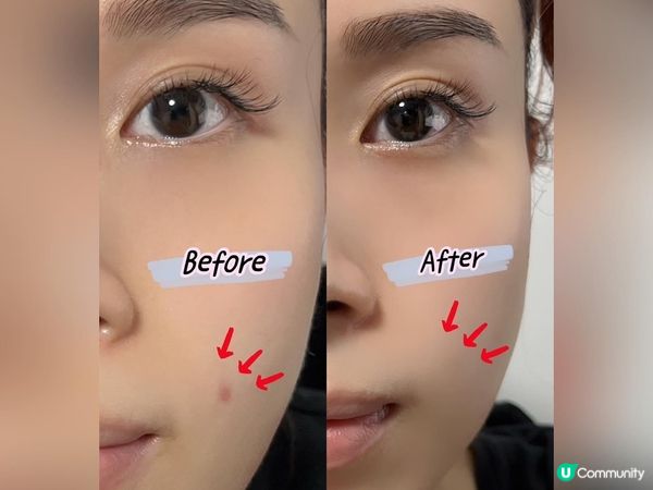 Dermaction PLUS by Watsons🩺