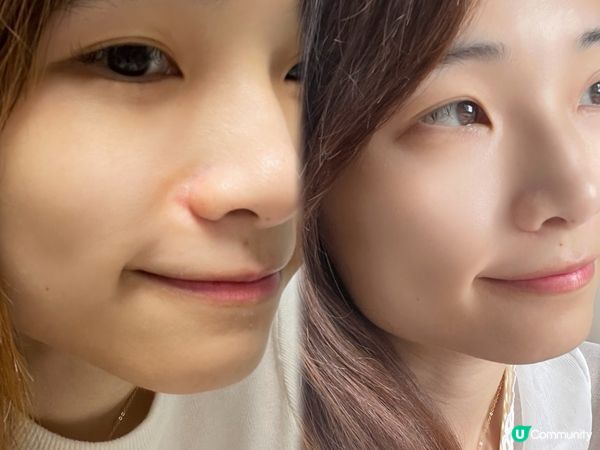 CAUDALIE Vinopure 葡萄淨化急救暗瘡膏