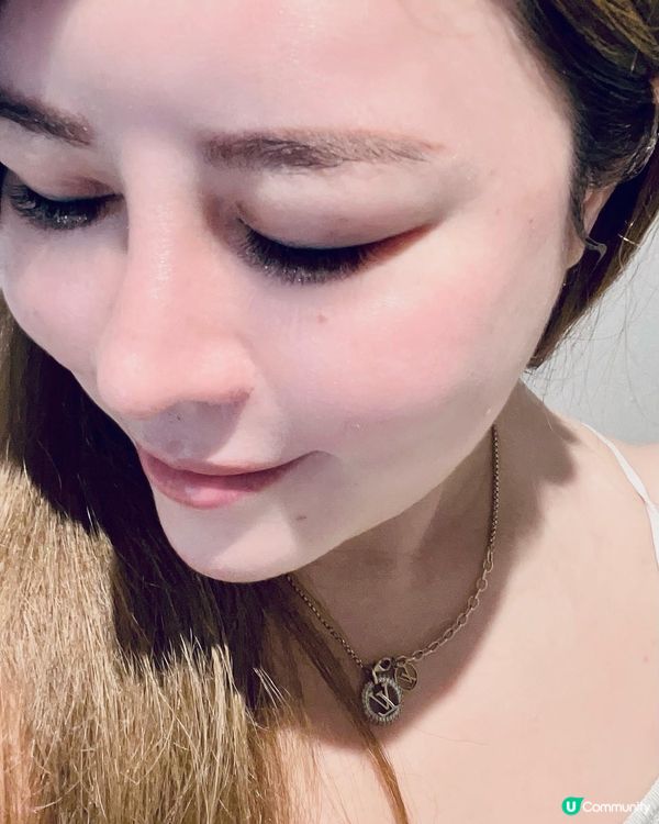 仿真無囊纹髮術