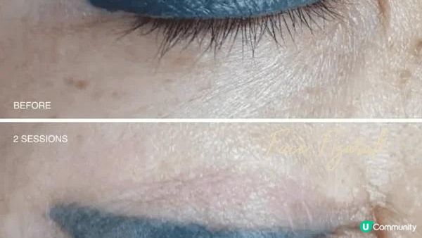 【洗眼線】2024洗眼線攻略│無痛洗眼線方法│附帶洗眼線推薦