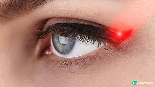 【洗眼線】2024洗眼線攻略│無痛洗眼線方法│附帶洗眼線推薦