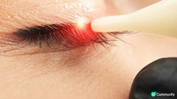 【洗眼線】2024洗眼線攻略│無痛洗眼線方法│附帶洗眼線推薦