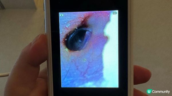 【台式採耳】TAO掏館｜專業採耳及耳燭服務真實體驗分享