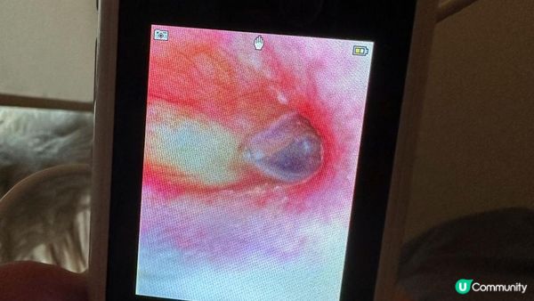 【台式採耳】TAO掏館｜專業採耳及耳燭服務真實體驗分享