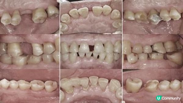 我的尋找專科牙醫之旅：推薦給受牙周病困擾的你