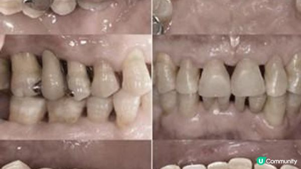 我的尋找專科牙醫之旅：推薦給受牙周病困擾的你