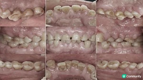 我的尋找專科牙醫之旅：推薦給受牙周病困擾的你