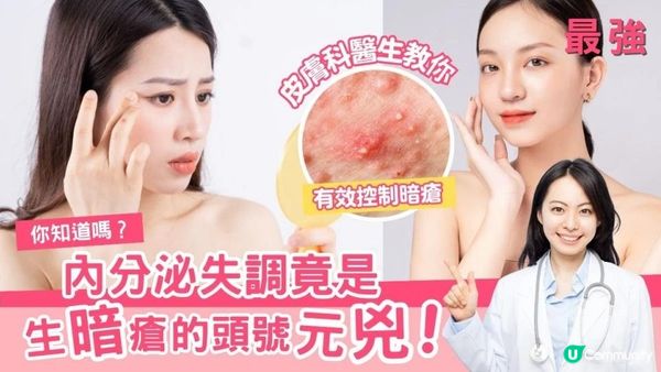 你知道嗎？內分泌失調竟是生暗瘡的頭號元兇！