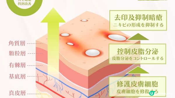你知道嗎？內分泌失調竟是生暗瘡的頭號元兇！