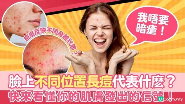 【皮膚管理】臉上不同位置長痘代表著什麽？快來看懂你的肌膚發出的信號！