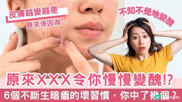【皮膚管理】6個不斷生暗瘡的壞習慣，你中了幾個？