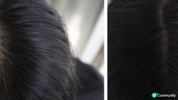 激光生髮真的work嗎？過來人分享2種舒適的生髮體驗：Teris Hair Consultant & Perfect Hair 這款更省時更見效，恢復茂密髮量不是夢！