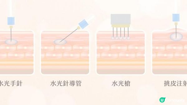 麗珠蘭初體驗Q&A：痛到往生？麗珠蘭黑盒/紅盒/白盒點揀？挑皮手針VS水光槍？