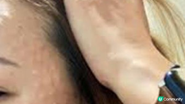 麗珠蘭初體驗Q&A：痛到往生？麗珠蘭黑盒/紅盒/白盒點揀？挑皮手針VS水光槍？