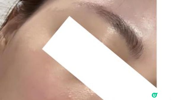 麗珠蘭初體驗Q&A：痛到往生？麗珠蘭黑盒/紅盒/白盒點揀？挑皮手針VS水光槍？