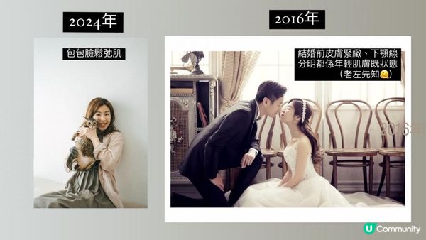 38歲～ 2025年踏出第一步 第一次 打膠原針！