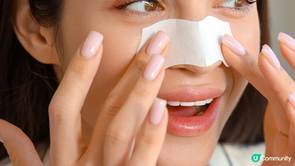 如何分辨黑頭和白頭粉刺？專家揭示最不推薦的兩種清除方式