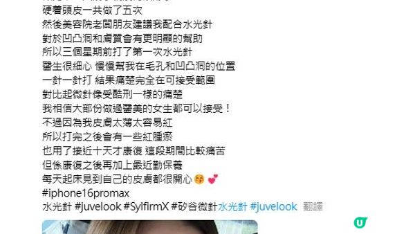 30+必做療程？凍齡逆齡神器Sylfirm X矽谷電波大解構：Sylfirm X原理？效果？副作用？附大量真人實證Sylfirm X效果圖！