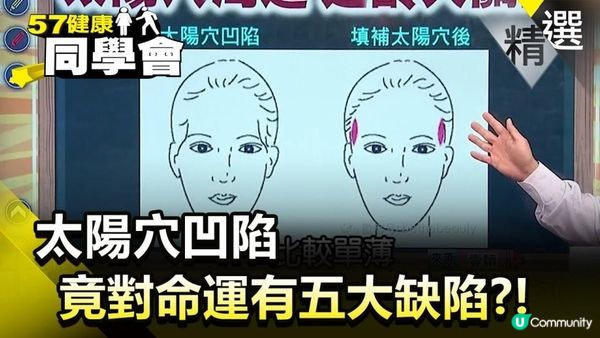 太陽穴凹陷影響婚姻？有咩方法可以破解？