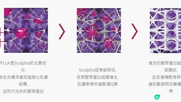 太陽穴凹陷影響婚姻？有咩方法可以破解？