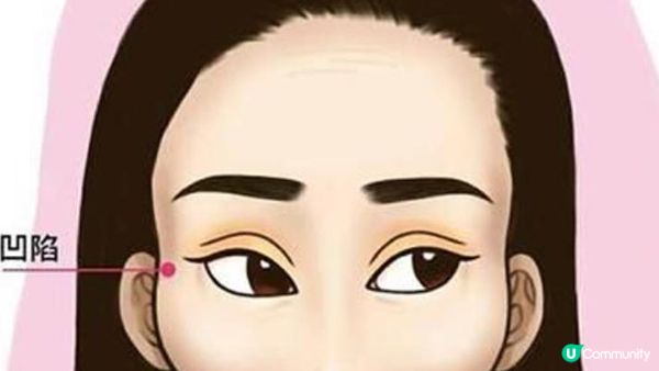 太陽穴凹陷影響婚姻？有咩方法可以破解？