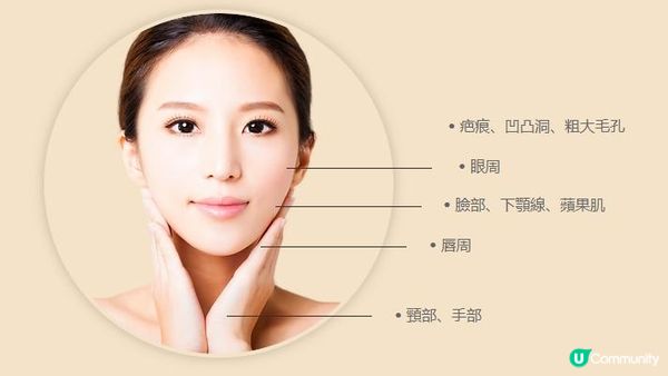 金秀賢37歲如同27歲？逆齡抗老神器：Profhilo逆時針功效！