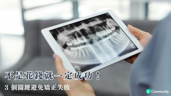 不是花錢就一定成功！3 個關鍵避免矯正失敗