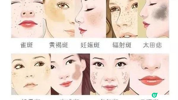 PICO有幾好？去斑迷思唔係人人都知！