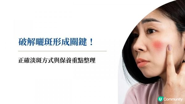 破解曬斑形成關鍵！正確淡斑方式與保養重點整理