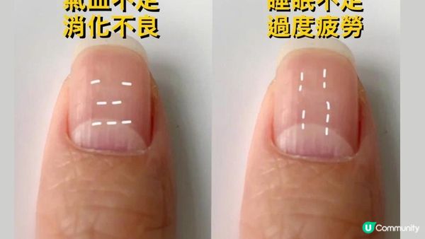 【點解睇相佬會咁準】其實學過手診👋 