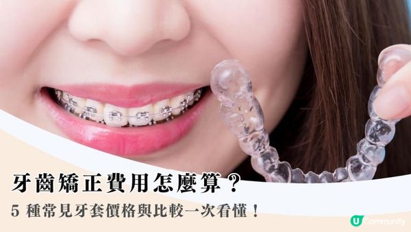 牙齒矯正費用怎麼算？5 種常見牙套價格與比較一次看懂！