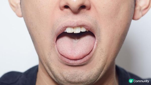 嘴凸、暴牙、深咬讓臉型不好看？森釉牙醫客製矯正，打造自信美!