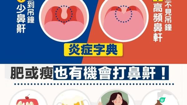 【#鼻鼾救星】有覺好瞓！#睡眠窒息 有得救😴