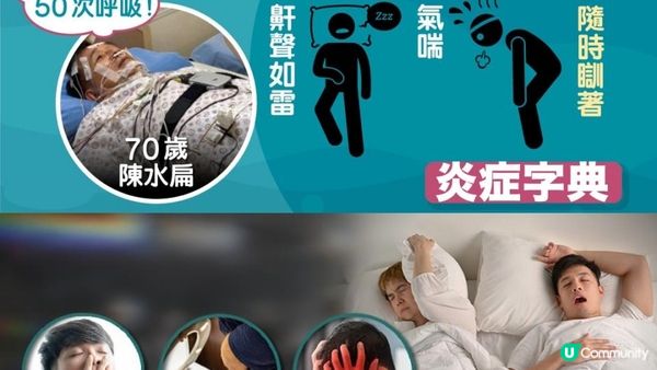 【#鼻鼾救星】有覺好瞓！#睡眠窒息 有得救😴
