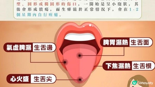 #生痱滋 只因熱氣？真相大揭秘🥵