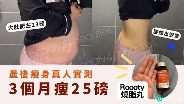 【產後瘦身真人實測】零運動照樣瘦！Roooty Super CLA+ 燒脂丸讓我三個月瘦25磅