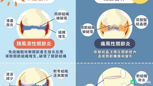 唔係絕症！最緊要天然消炎