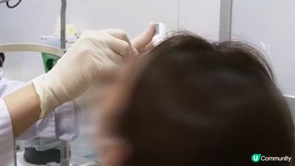 【裝修佬文章轉載】洗衣珠會爆炸？女子做錯1事致眼角膜灼傷險失明 切勿存放於這類地方