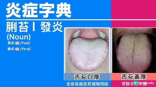快D「#伸脷」😝睇穿你健康