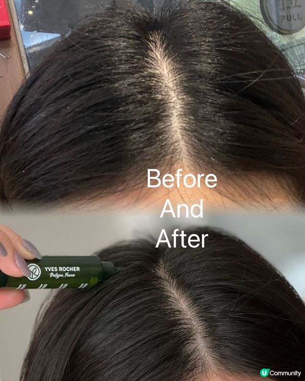 告別地中海！頭髮密密實實💪🏻✨