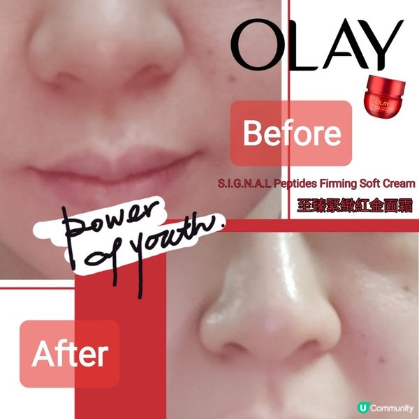 皮膚吃乳酪，瞬間變年輕？！