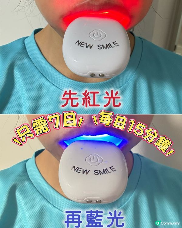 七日美白牙齒 喺屋企就得