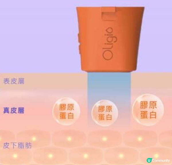 蘋果肌有下滑跡象……help! 同病者請進！